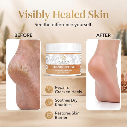 Frankincense Essential Balm